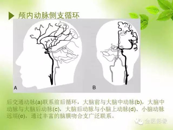 干华:脑侧支循环影像评估及临床意义