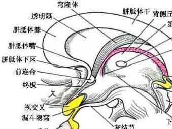 经胼胝体-透明隔-穹隆手术切除第三脑室肿瘤