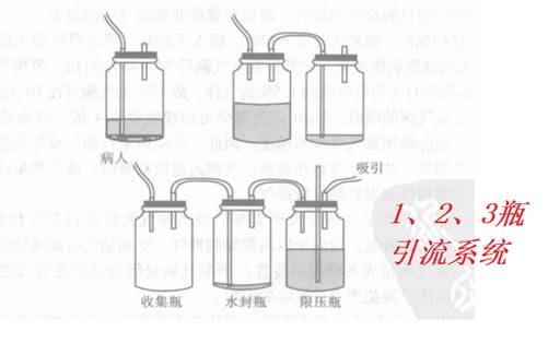 胸腔闭式引流,这些你全掌握了吗?