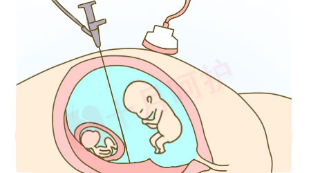 双胞胎是怎么形成的?