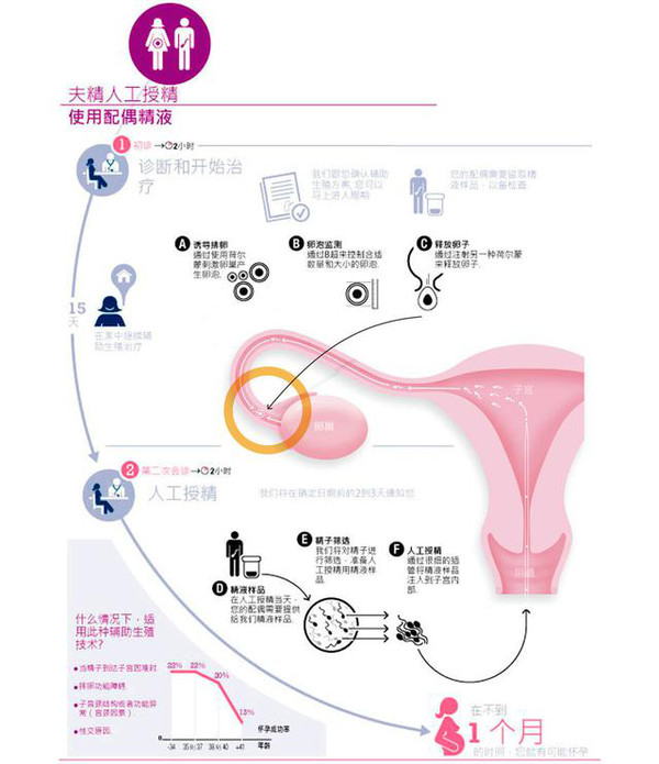 试管婴儿智力水平综述