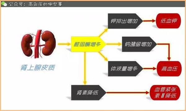 醛固酮增多症型高血压有哪些特点