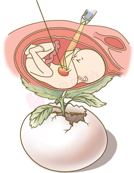 产检发现胎儿畸形,也许可以这样挽救!