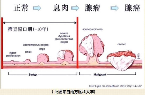 一,息肉形成与生长过程