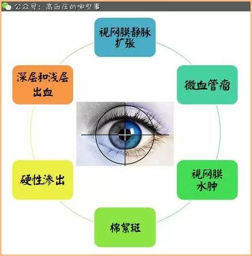 高血压性视网膜病变的危害及治疗?