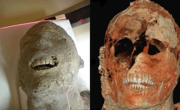 在庞贝古城中发现千年石化木乃伊,看完以后震惊了