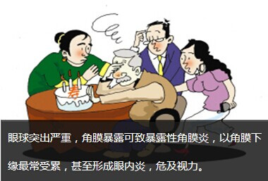 甲状腺相关眼病症状大点兵