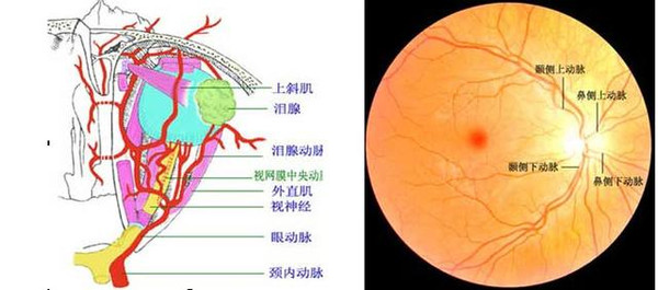 突然视物不见视网膜中央动脉阻塞