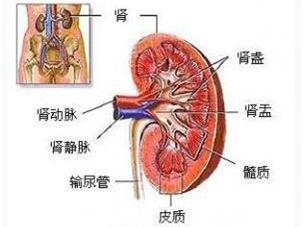 【患者医生一问一答】肾盂癌的要点科普