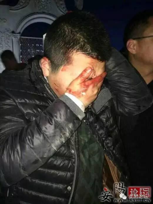 噩梦:安阳人在磁县昊林灯展被暴打?