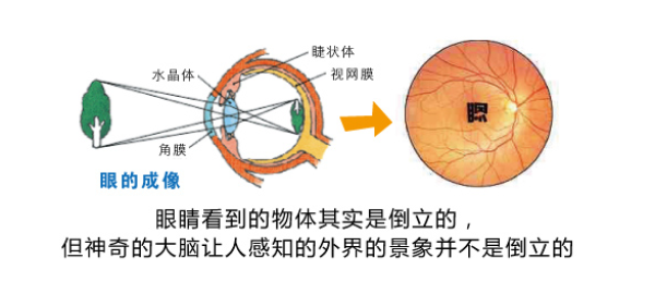 健视加云+智能眼镜:杭州近视眼矫正进入非手