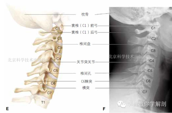 特殊颈椎(图1.3 i~k) 1. c1:寰椎 a. 无椎体;类似于环形 b.