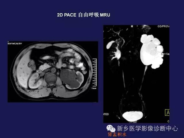 图文结合,秒懂ct,mri!