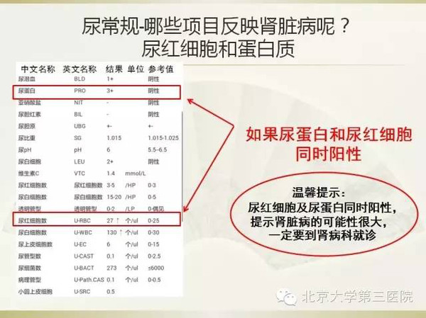 【三院科普】读懂尿常规?远离肾衰竭