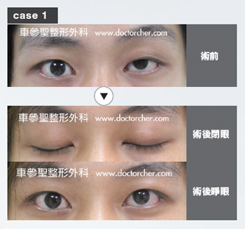 摆脱大小眼