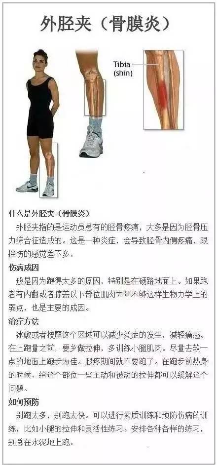 体育 正文 跑步膝,跳高膝,足底筋膜炎,跟腱肌腱炎,骨膜炎,髂胫束综合