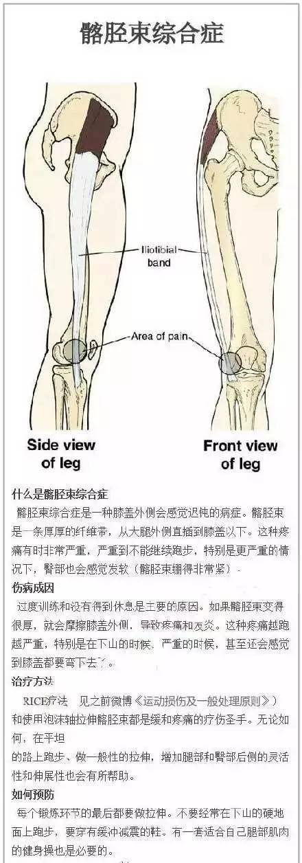 外胫夹(骨膜炎)no4.跟腱肌腱炎no3.足底筋膜炎no2.跳高膝