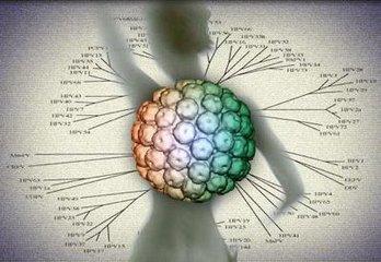 谈宫颈癌的致病"元凶—hpv