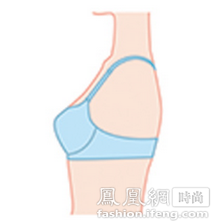 被内衣勒红了怎么办_皮肤被贴的红了怎么办(3)