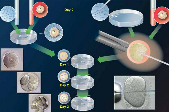 ICSI技术的安全性