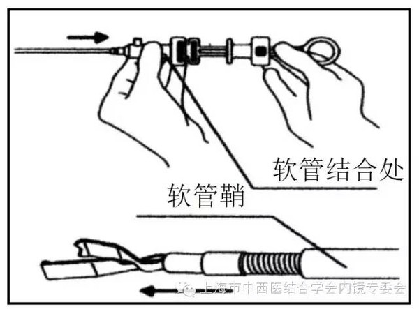 消化内镜专业护理系列内镜下金属夹子操作