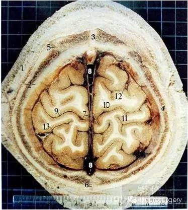 颅脑断层解剖图这些才是经典