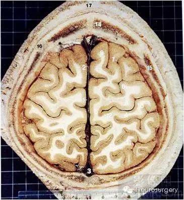 颅脑断层解剖图,这些才是经典!