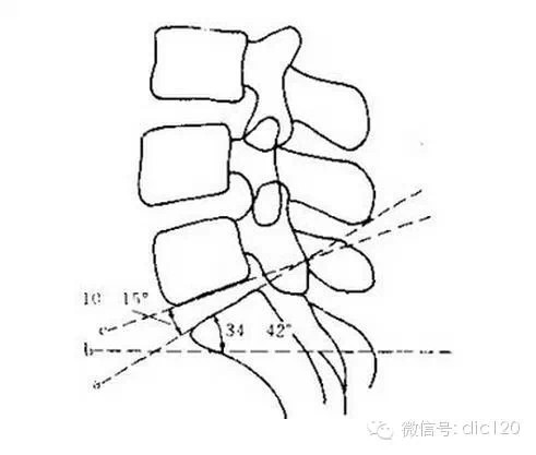 手把手教你判断骶椎腰化/腰椎骶化