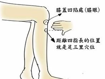 腰椎间盘突出引起的大腿疼痛可以用艾灸吗？ .艾灸养生