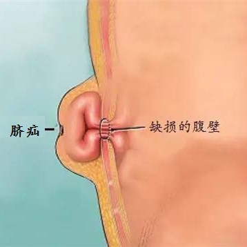 "三八"妇女节,从专业角度谈做女人的利和弊