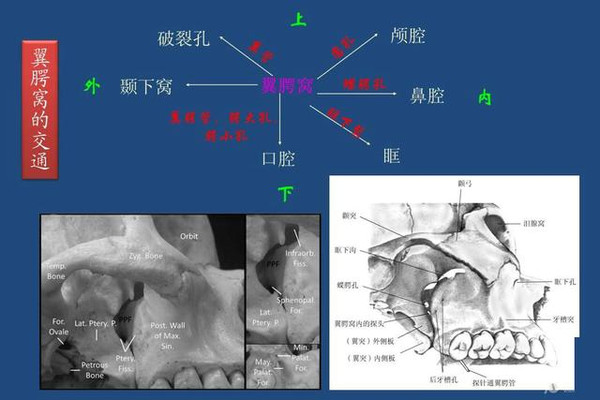 翼腭窝的结构