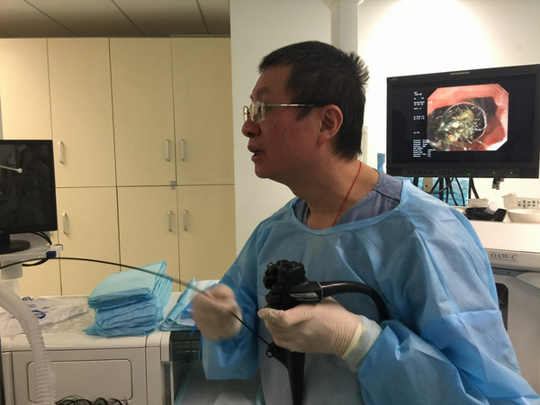 北京友谊医院消化内镜专家取出胃内巨大毛发团