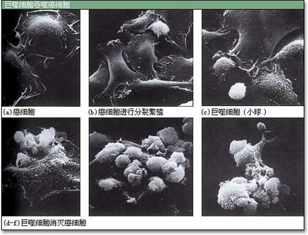 巨噬细胞肿瘤发生发展的双刃剑