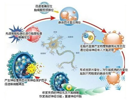 生物激活介入修复疗法 神经疾病诊疗金标准