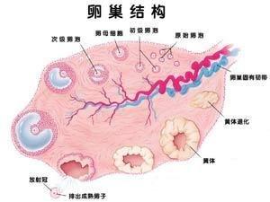 一 什么是多囊卵巢综合症?