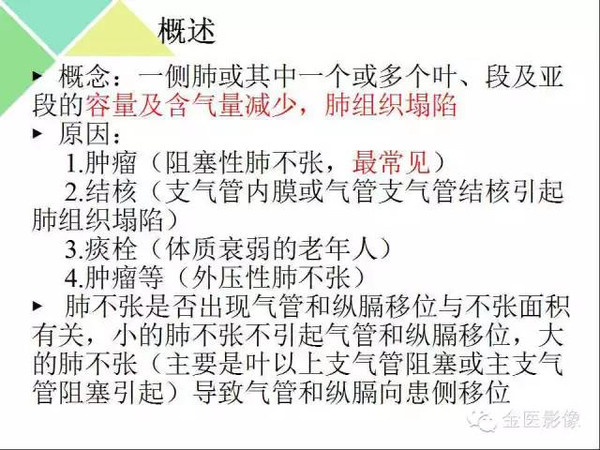 肺不张+肺实变,这些影像特征你当知!,肺不张与