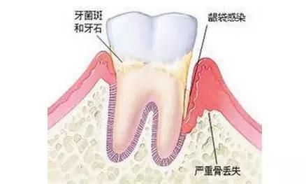 成人口中的变硬_正常宫颈口的图片