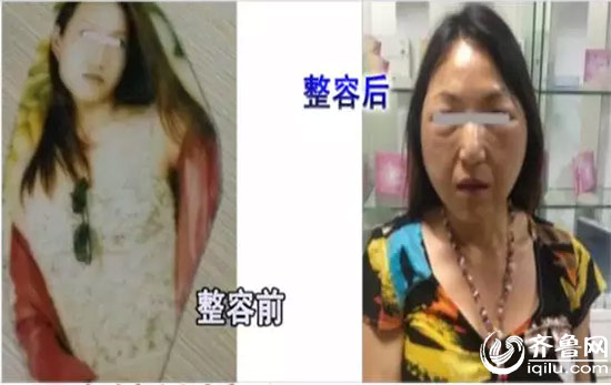 男子微整后面部浮腫變形(視頻截圖)