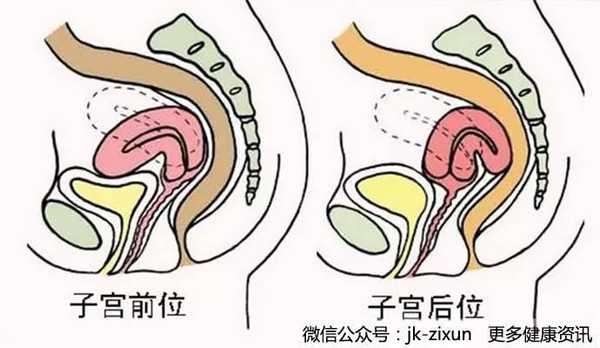 子宫后位会影响怀孕吗?