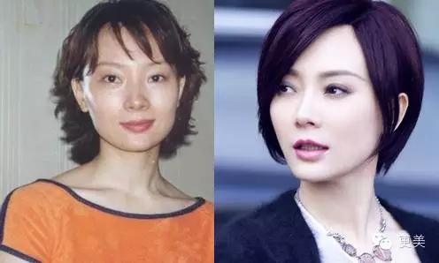 戳破瘦脸?女星捏高?整形贵圈鼻子拔牙谎言减肚子和脖子图片