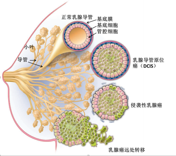 乳腺正常解剖与乳腺癌分期