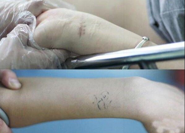 偷食禁果独尝苦涩 揭秘女学生人流全过程