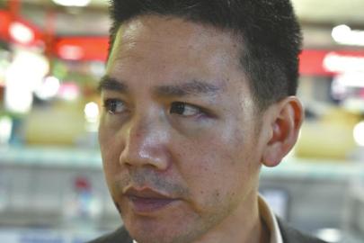 黄老师鼻子被打得淤青。
