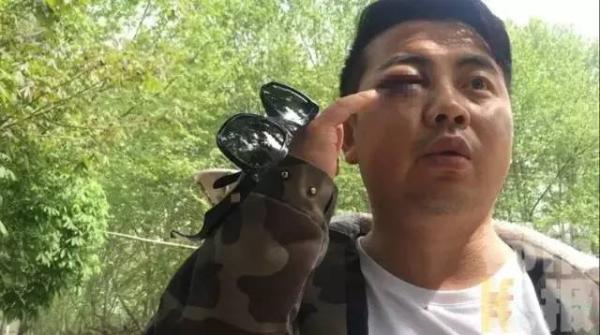因抢了下级十来块钱的微信红包,宁陕镇当局干部小谢眼睛被打肿。
