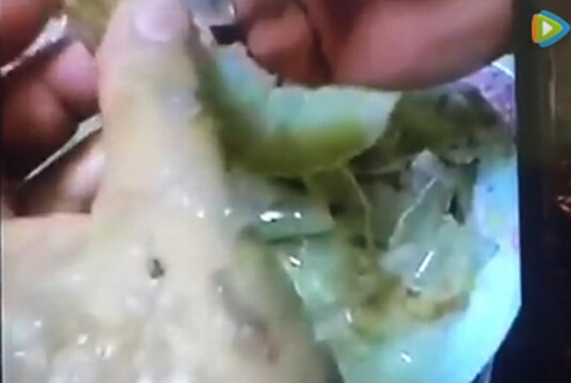 究竟虾壳里藏的这些胶状物,是什么东西呢?记者昨天(17日)来到了其中一名网民卖虾的地方,广东普宁占陇市场。了解到那些就是传说中的注胶虾,是不法商贩人为地将明胶注射进虾体内。这不仅能增加虾的重量,而且还可以避免冰鲜后的虾头出现凹陷、塌瘪等现象,使虾显得更饱满、新鲜。