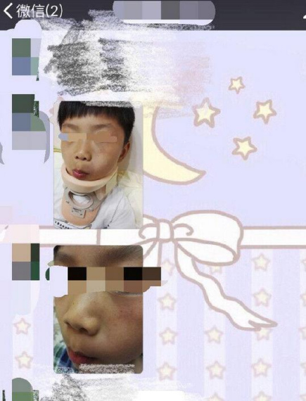 幼儿园教师让男孩互殴 称可发泄旺盛精力(图),