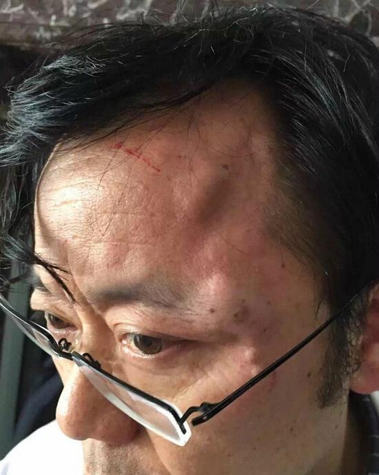 江西一医生宣布患者抢救无效死亡后遭围殴 警