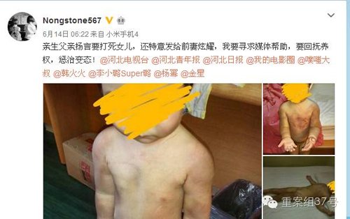 网名“Nongstone567”的李密斯发微博称女儿遭逢前夫殴伤。 微博截图