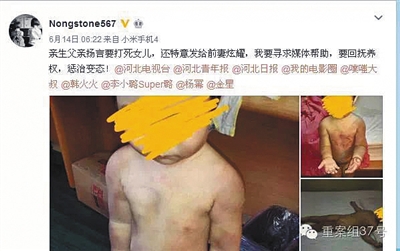 网友“Nongstone567”发布微博称,女儿遭前夫殴打。