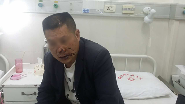被打伤的田邦贵。
